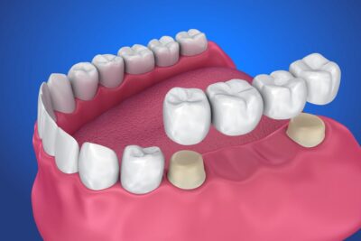 Los dientes: definición y características | ILERNA